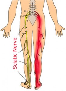 See that red ouchie looking line? That is how I feel (down to the knee).